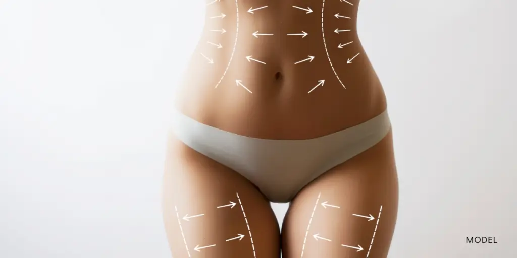 Body with arrows for surgery